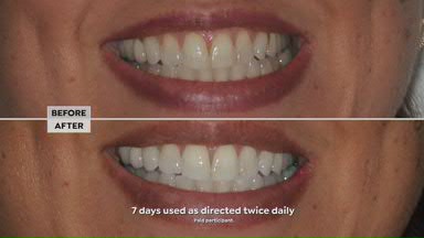 View video